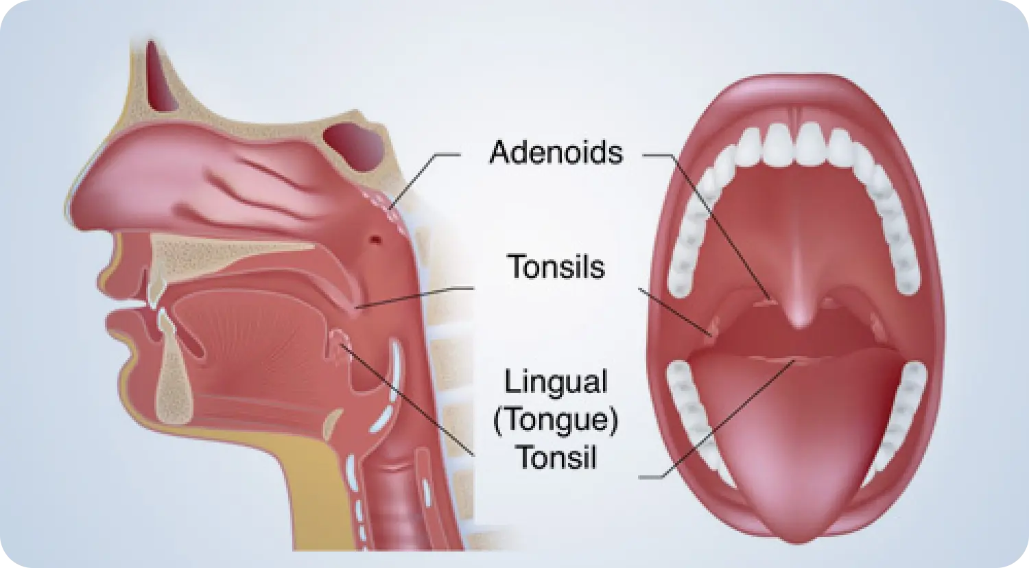 Tonsils & Adenoids